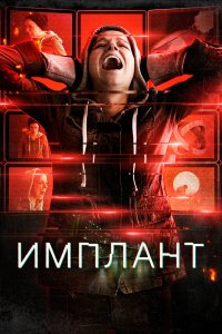 Имплант - постер